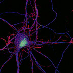 Researchers use color-coded fluorescence images, such as the one above, to visualize the nerve ce...