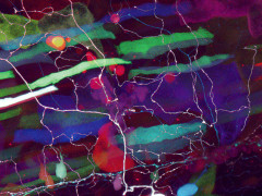 This image of a living zebrafish, taken by Tobias, shows a brightly labeled neuron with its cell body (white) at bottom. It illustrates a delicate branching process that is collecting sensory information and relaying it to the brain. Multicolored short stripes are labeled muscle fibers.