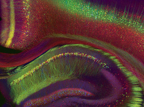 ￼Weissman-Unni's image shows a mouse brain that has been genetically modified to express three different fluorescent proteins (red, yel...