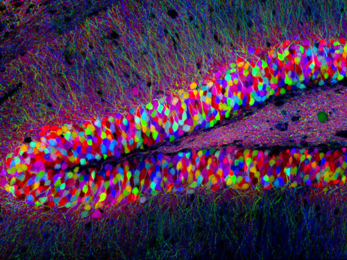 This image, which shows multicolor neurons in the hippocampus of a brainbow mouse, has been featured in several imaging competitions and ...