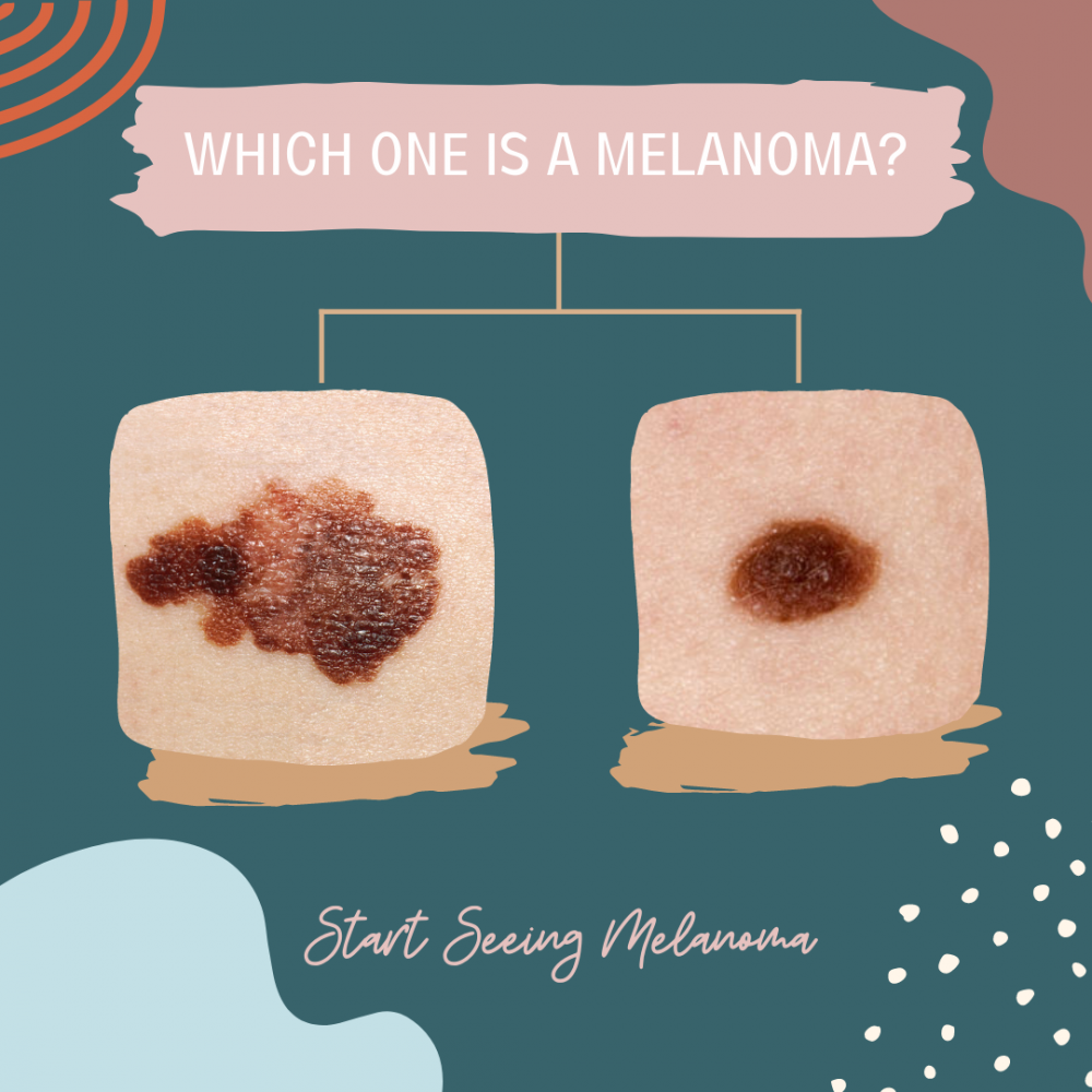 The Start Seeing Melanoma campaign uses a spot-the-difference strategy to help people gain an u...