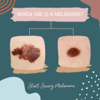 Start Seeing Melanoma campaign graphic